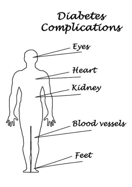 Diabetes komplikationer