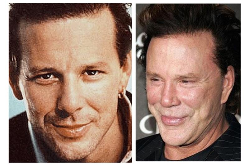 mickey rourke kauneus op